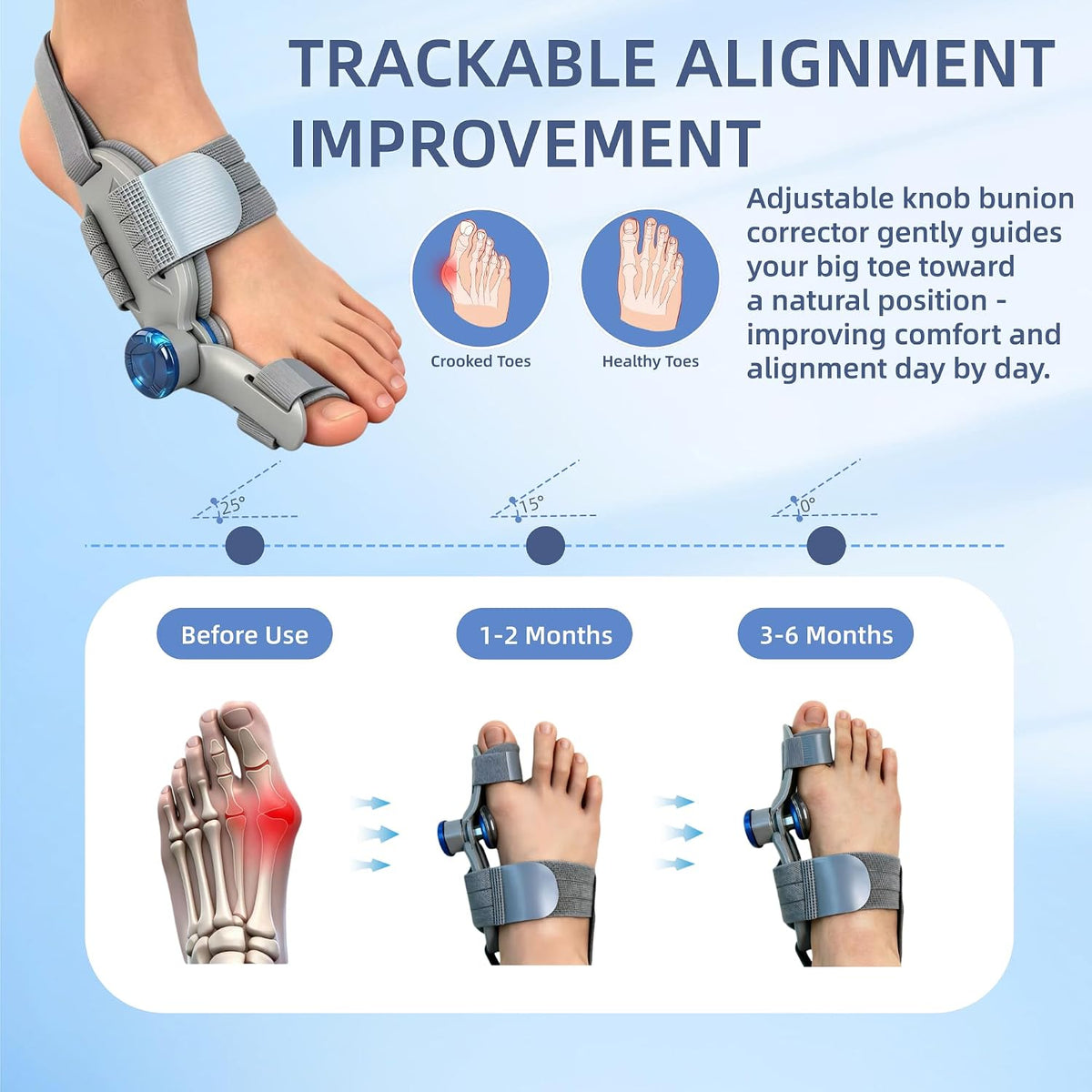 ILIYAH® Hallux Valgus Komfort-Set für Tag & Nacht